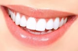 Mẹo “tự chế” giúp răng trắng sáng tự nhiên