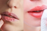 Cách trị môi khô nứt nẻ bằng nguyên liệu sẵn có tại nhà để mùa đông khô hanh nhưng môi vẫn căng mọng