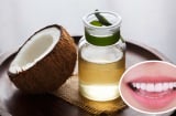 Súc miệng bằng dầu dừa có 3 lợi ích tuyệt vời, ai cũng cần