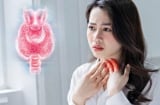 Căn bệnh ung thư phổ biến đứng thứ 7 thế giới: Người Việt dưới 40 tuổi mắc tăng gấp đôi sau 10 năm
