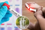 4 cách đào thải axit uric ra khỏi cơ thể nhanh chóng