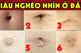 Nhìn tướng rốn 3 giây biết tương lai giàu sang hay nghèo khổ