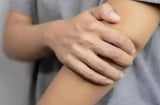 Cảnh báo ung thư: 4 dấu hiệu ở cánh tay tuyệt đối không được bỏ qua – Phát hiện sớm cứu sống bạn