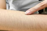 Nơi nào càng mọc nhiều lông càng có lợi cho sức khỏe? Tại sao nhiều người vẫn tẩy sạch, đặc biệt là phái nữ?