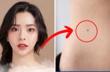 Phụ nữ có 3 nốt ruồi ở vị trí hiếm này: Số mệnh phú quý, viên mãn, tình tiền sáng rực rỡ