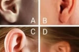 Trắc nghiệm tâm lý: Chọn hình dáng tai giống bạn nhất để biết bạn có giàu sang, may mắn?