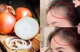 Mẹo sử dụng hành tây giúp tóc con mọc tua tủa, càng dùng tóc càng dày và bóng mượt