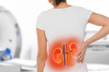 7 dấu hiệu cảnh báo suy thân: Có 1 cũng nên đi khám sớm