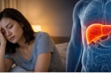 4 dấu hiệu buổi tối cảnh báo gan đang suy yếu, chớ chủ quan kẻo ân hận