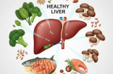 Bác sĩ Harvard bật mí cách đẩy lùi gan nhiễm mỡ không cần thuốc: Chỉ cần thay đổi 2 thói quen mỗi ngày