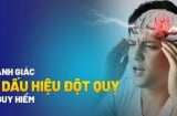 Dấu hiệu đột quỵ trước 1 tuần: Nhận biết sớm để tránh biến chứng nguy hiểm