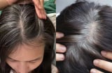 3 nhóm người dễ bị tóc bạc sớm, ngoài 30 tuổi tóc đã bạc trắng