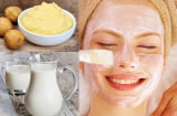 4 cách làm mặt nạ khoai tây hỗ trợ giảm mụn và làm sáng da tại nhà