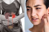 5 dấu hiệu trên mặt cảnh báo suy thận đang âm thầm xảy ra