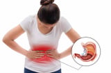 5 biểu hiện của bệnh dạ dày: Có 1 cũng nên đi khám sớm