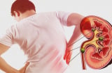 5 dấu hiệu suy thận giai đoạn đầu ở nam giới: Biết sớm tránh chạy thận suốt đời