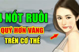 4 nốt ruồi mang tới may mắn đừng dại xóa đi
