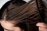 3 thói quen tưởng vô hại khiến tóc nhanh bết và da đầu dễ đổ dầu