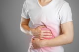 4 dấu hiệu bạn đang mắc bệnh dạ dày nên đi kiểm tra sức khỏe sớm