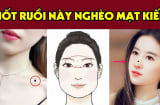 3 nốt ruồi lận đận nên tìm cách hóa giải kẻo về già cô độc
