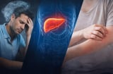 5 dấu hiệu cơ thể tưởng bình thường nhưng có thể K đã tấn công