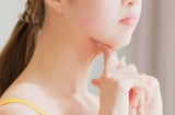 Mẹo ăn uống giúp giảm béo mặt, giảm nọng cằm