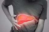 6 dấu hiệu cảnh báo suy gan thường xuất hiện vào buổi tối