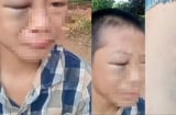 Đang xác minh vụ bé trai 12 tuổi, nghi bị bố và mẹ kế bạo hành