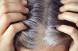Tóc bạc sớm và rụng nhiều trước tuổi 40: Nhiều phụ nữ bắt đầu chú ý hơn đến top thực phẩm này