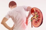 4 dấu hiệu cảnh báo thận của bạn đang kêu cứu