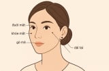3 nốt ruồi trên mặt mang tới may mắn cho bạn: Cả đời bình an