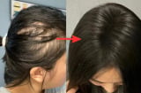Lời khuyên dành phụ nữ có tóc rụng nhiều, mọc chậm, tóc càng ngày càng mỏng