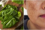 Cách dùng lá trầu không giúp da căng bóng hết nám, tàn nhang: Ai biết rồi cũng muốn làm theo