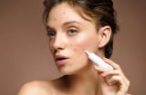 6 cách giúp làm mờ thâm sau mụn và phục hồi làn da sáng khỏe hiệu quả hơn