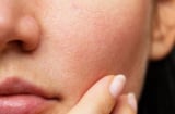 Ngồi điều hòa nhiều khiến da khô ráp? Thử ngay phương pháp dưỡng da “nhiều lớp” để giữ da căng mịn