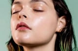 Chuyên gia cảnh báo sai lầm chăm sóc da dầu nhiều người mắc phải vào mùa hè