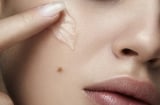 5 cách hỗ trợ làm mờ thâm lâu năm, giúp làn da đều màu và rạng rỡ hơn