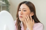 3 sai lầm chăm sóc da nhiều người mắc phải vào mùa hè khiến da đổ dầu, nổi mụn và nhanh lão hóa