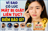 Vì sao có lúc mắt bị giật liên tục? Điềm báo gì?
