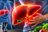 Những biểu hiện cảnh báo gan đang làm việc quá tải