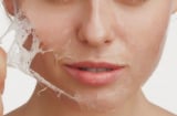 7 dấu hiệu cảnh báo làn da đang mất dần collagen, nhiều người gặp phải nhưng dễ bỏ qua