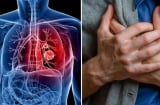 5 dấu hiệu nguy hiểm cảnh báo ung thư phổi, không phải ho như nhiều người nghĩ