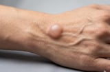 Cảnh báo: 4 thay đổi bất thường ở cánh tay có thể là 'tín hiệu cầu cứu' của cơ thể trước bệnh ung thư