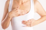 5 dấu hiệu cảnh báo bệng K vú ở phụ nữ: Ai cũng nên biết sớm