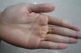 4 nốt ruồi trên bàn tay mang tới may mắn cho bạn: Ai có thật đáng chúc mừng