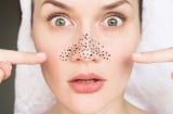4 sai lầm phổ biến khiến mụn đầu đen ngày càng nhiều dù chăm sóc da đều đặn
