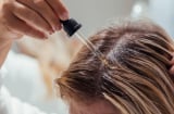 Tóc nhanh bết dù mới gội? 5 thói quen giúp kiểm soát dầu thừa và giữ mái tóc sạch lâu hơn
