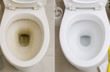 Bồn cầu ố vàng mãi không sạch? 5 cách xử lý đúng giúp đánh bay mảng bám mà không làm hại men sứ