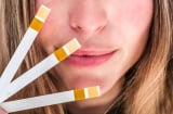 Bí quyết duy trì làn da khỏe mạnh và hạn chế lão hóa từ hàng rào bảo vệ tự nhiên
