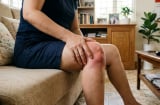 Thấy 5 dấu hiệu này, cảnh báo khớp gối đang thoái hóa